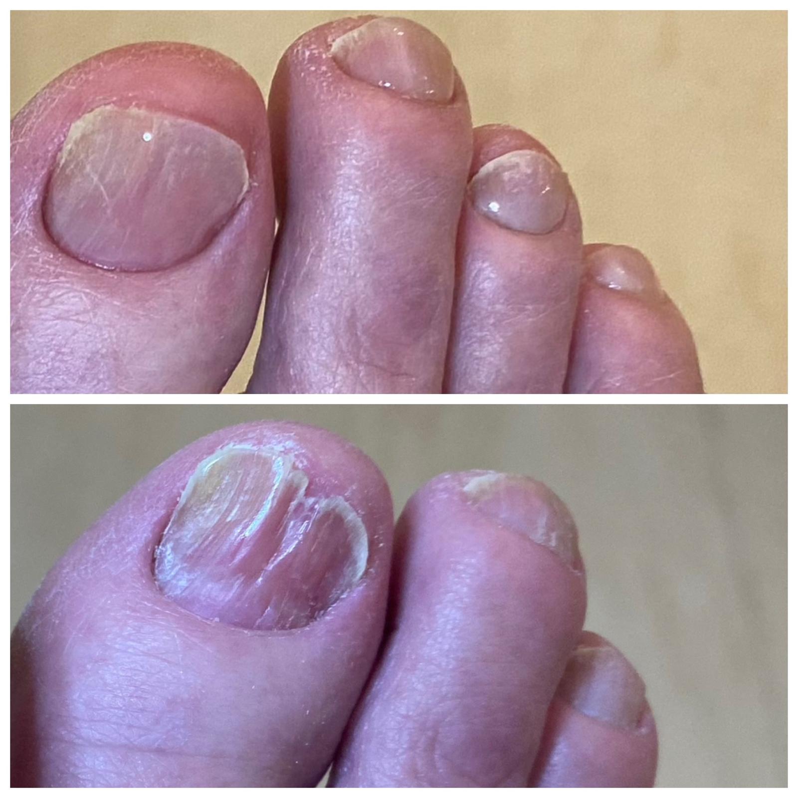 Nagelrekonstruktion. Ab €37,- pro Nagel.